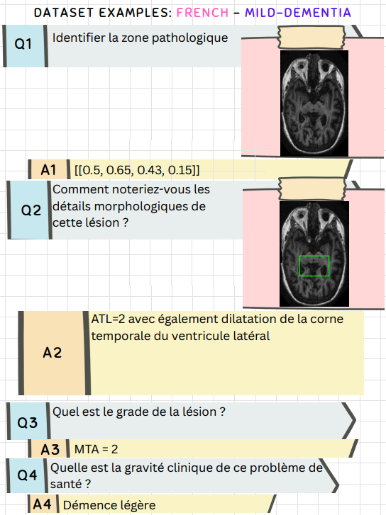 French dataset example