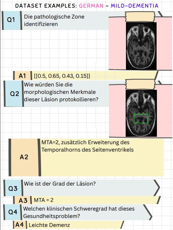 German dataset example