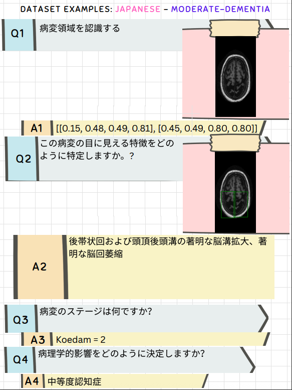 Japanese dataset example